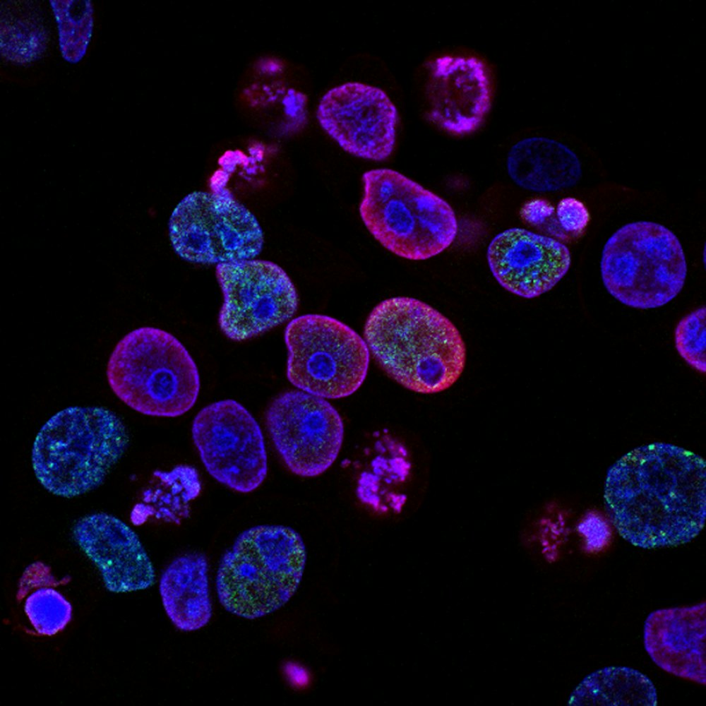Análisis especializado por microscopía de fluorescencia
